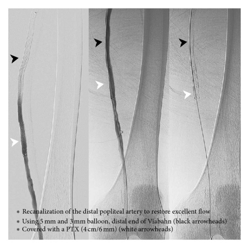 Details are in the caption following the image