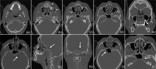Details are in the caption following the image Details are in the caption following the image
