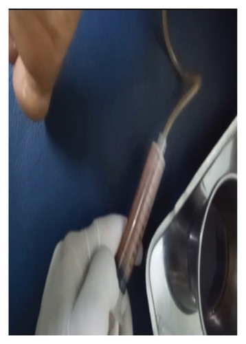 Details are in the caption following the image