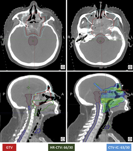 Details are in the caption following the image Details are in the caption following the image