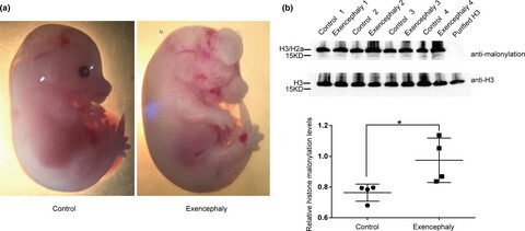 Identification of histone malonylation in the human fetal brain and implications for diabetes-induced neural tube defects