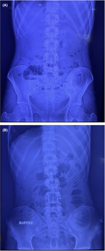 Details are in the caption following the image Details are in the caption following the image