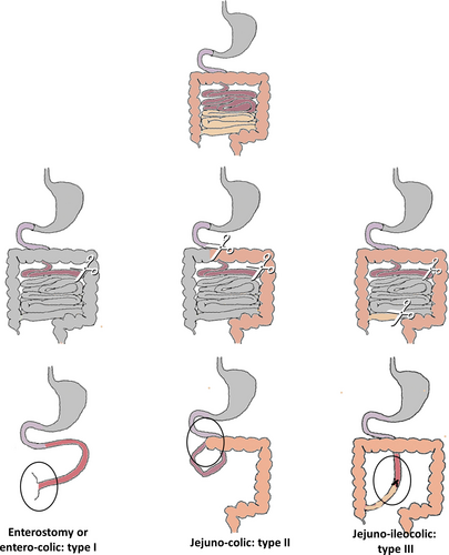 Details are in the caption following the image