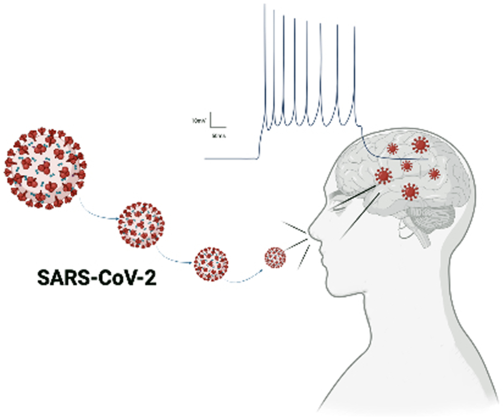 Status epilepticus and the presence of SARS-COV-2 in the cerebrospinal fluid: A case report