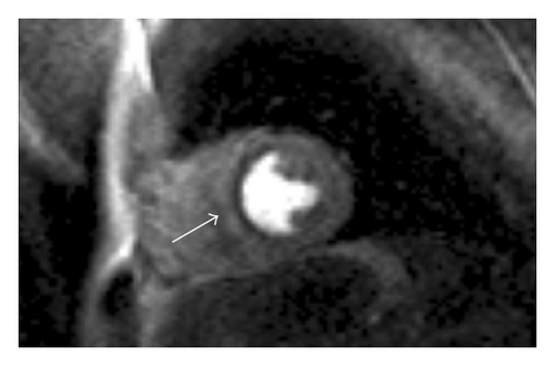 Details are in the caption following the image