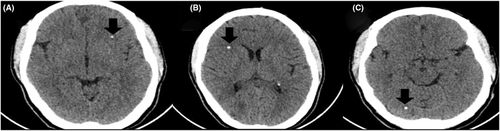 Details are in the caption following the image Details are in the caption following the image