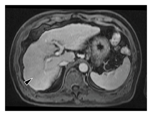 Details are in the caption following the image