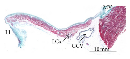 Details are in the caption following the image
