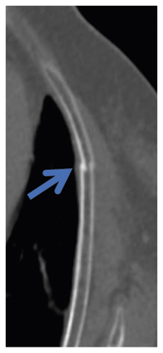 Details are in the caption following the image
