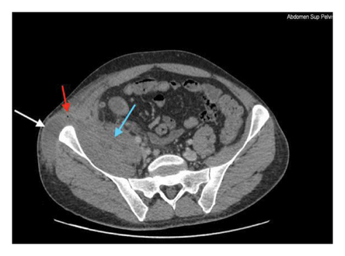 Details are in the caption following the image Details are in the caption following the image