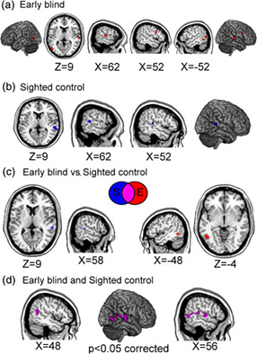 Social cognition in the blind brain: A coordinate-based meta-analysis