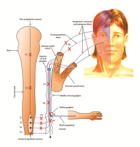 Details are in the caption following the image Details are in the caption following the image
