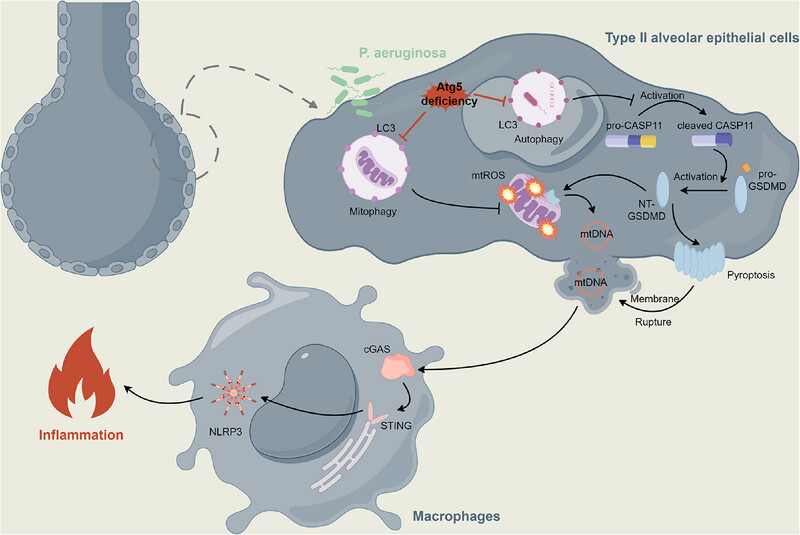 Epithelial Atg5 Deficiency Intensifies Caspase-11 Activation, Fueling Extracellular mtDNA Release to Activate cGAS–STING–NLRP3 Axis in Macrophages During Pseudomonas Infection