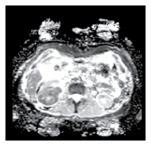 Details are in the caption following the image