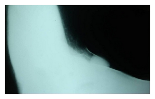 Details are in the caption following the image