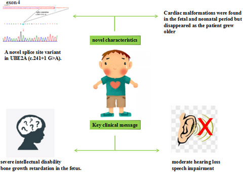 A novel UBE2A splice site variant causing intellectual disability type Nascimento
