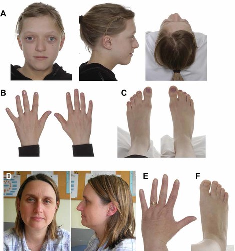 Details are in the caption following the image Details are in the caption following the image