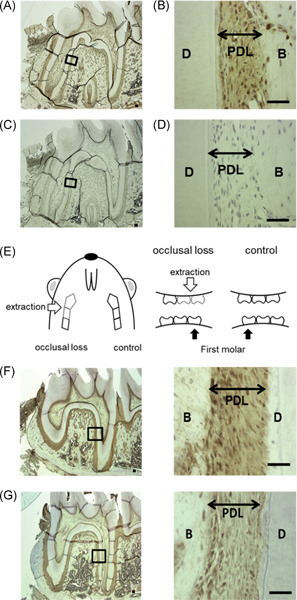 Functions of beta2-adrenergic receptor in human periodontal ligament cells