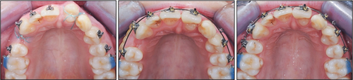 Details are in the caption following the image Details are in the caption following the image