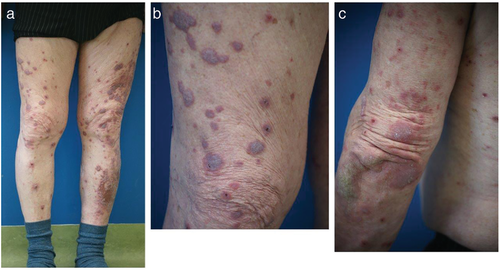 Details are in the caption following the image Details are in the caption following the image