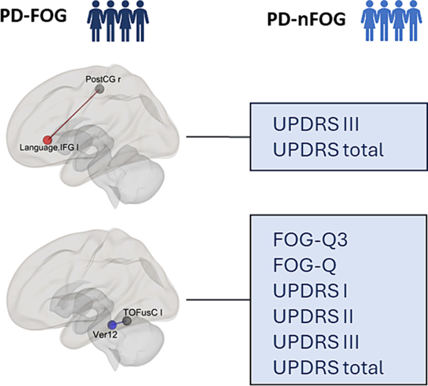 Functional connectivity compensation in Parkinson's disease with freezing of gait