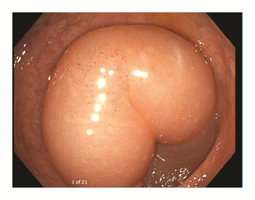 Details are in the caption following the image Details are in the caption following the image