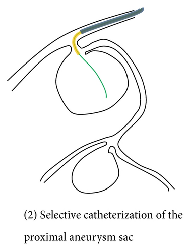 Details are in the caption following the image