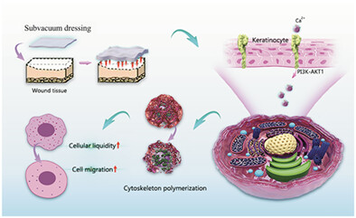 Subvacuum environment-enhanced cell migration promotes wound healing without increasing hypertrophic scars caused by excessive cell proliferation