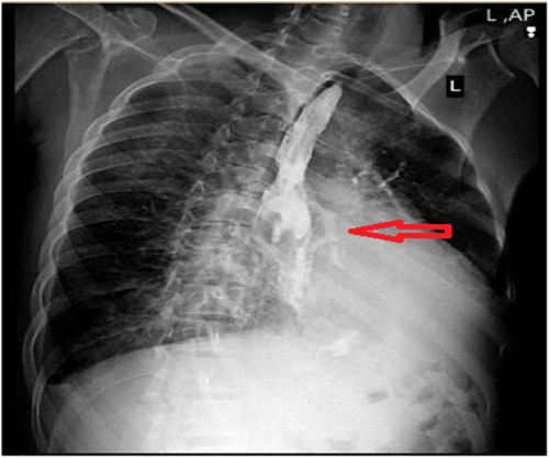 Details are in the caption following the image Details are in the caption following the image