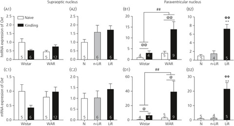 Neuroendocrine changes in the hypothalamic-neurohypophysial system in the Wistar audiogenic rat (WAR) strain submitted to audiogenic kindling
