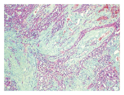 Details are in the caption following the image