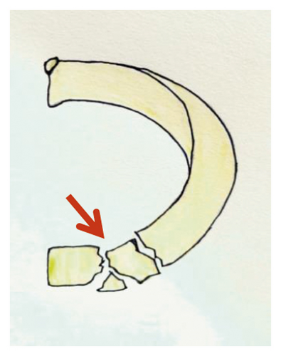 Details are in the caption following the image