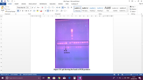 Biochemical, serological, and genetic aspects related to gene HLA-DQB1 and its association with type 1 diabetes mellitus (T1DM)