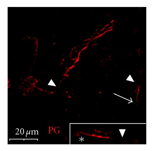 Details are in the caption following the image