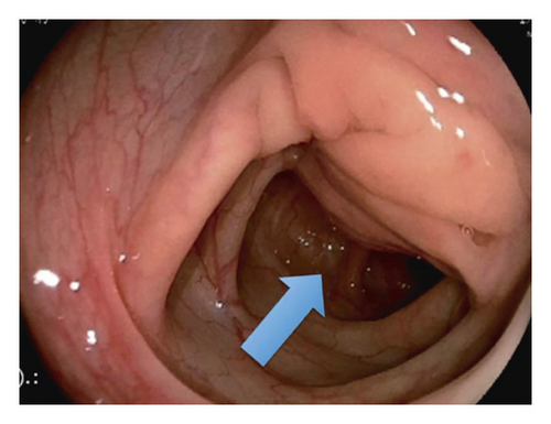 Details are in the caption following the image Details are in the caption following the image