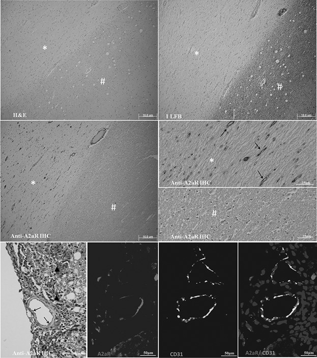 Adenosine A2A receptor agonist ameliorates EAE and correlates with Th1 cytokine-induced blood brain barrier dysfunction via suppression of MLCK signaling pathway