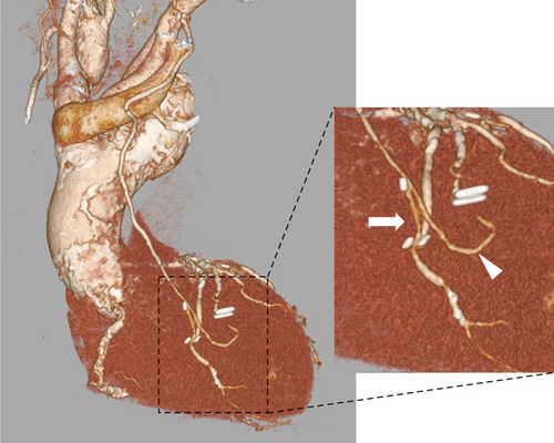 Details are in the caption following the image
