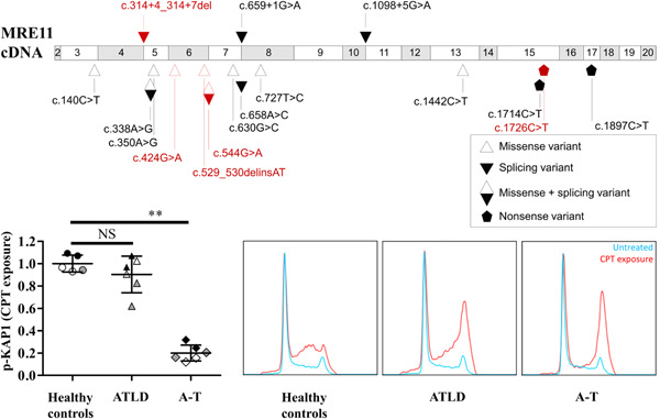 Three new cases of ataxia-telangiectasia-like disorder: No impairment of the ATM pathway, but S-phase checkpoint defect