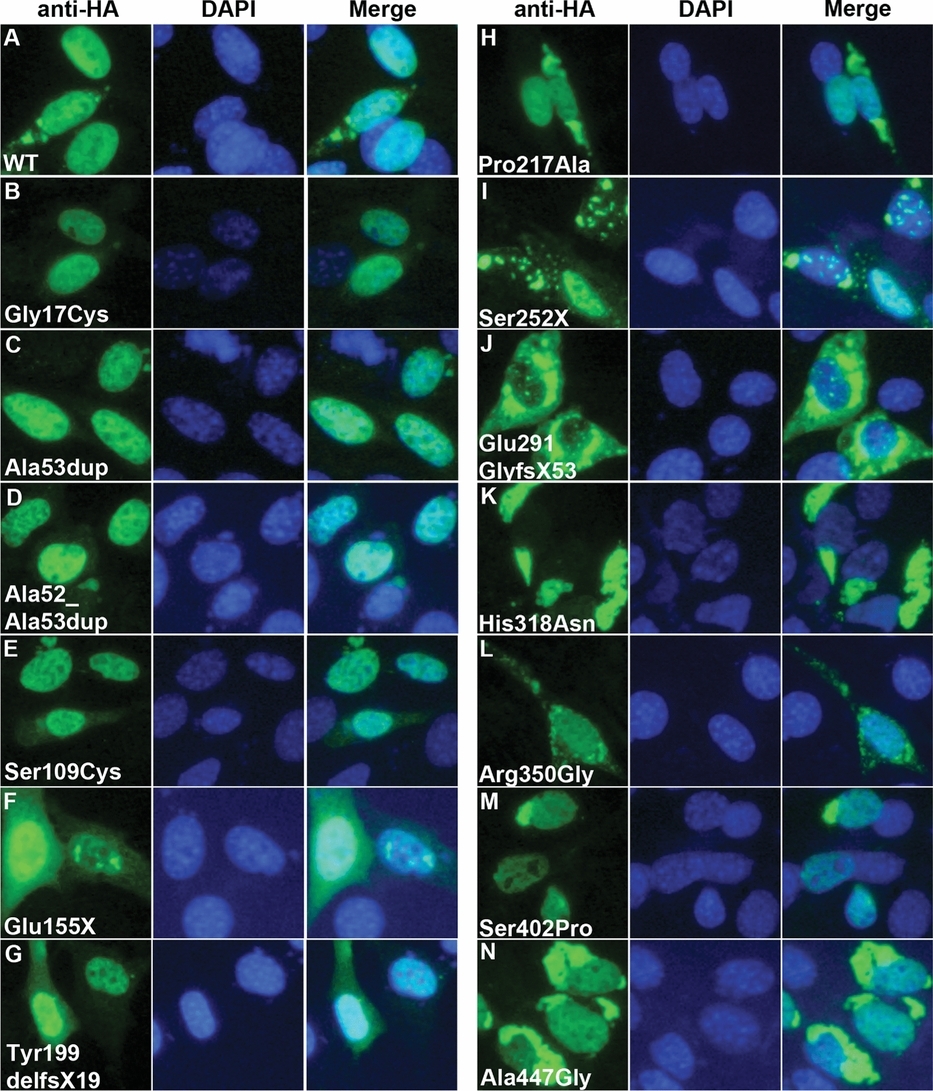 Genetic and Functional Analyses of ZIC3 Variants in Congenital Heart Disease