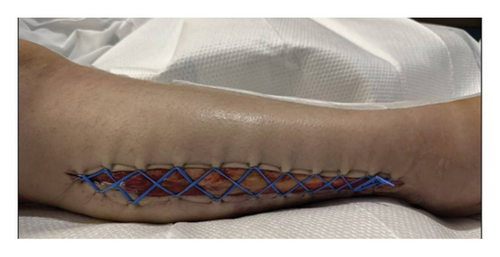 Details are in the caption following the image Details are in the caption following the image
