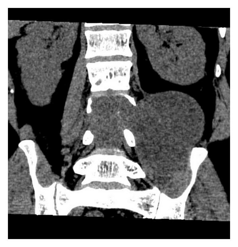 Details are in the caption following the image