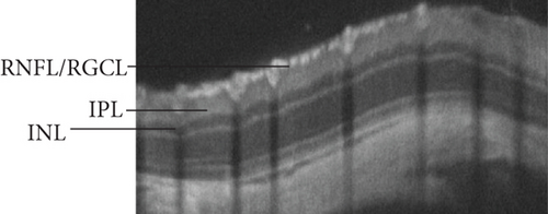 Details are in the caption following the image