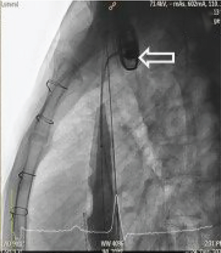 Details are in the caption following the image Details are in the caption following the image