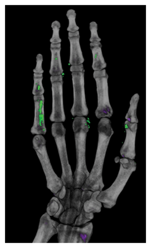 Details are in the caption following the image