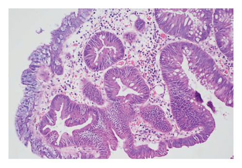 Details are in the caption following the image