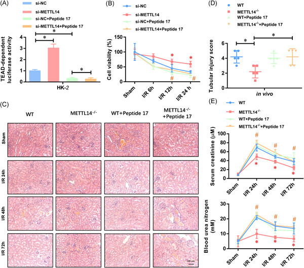 The N6-methyladenosine mRNA methylase METTL14 promotes renal ischemic reperfusion injury via suppressing YAP1