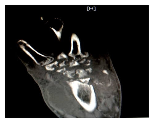 Details are in the caption following the image