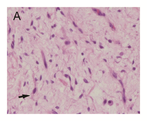 Details are in the caption following the image