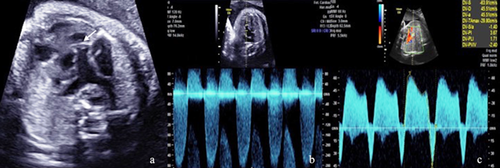 Details are in the caption following the image Details are in the caption following the image