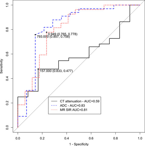 Utility of absolute apparent diffusion coefficient and chemical-shift imaging versus CT attenuation for predicting malignancy from percutaneous bone biopsies